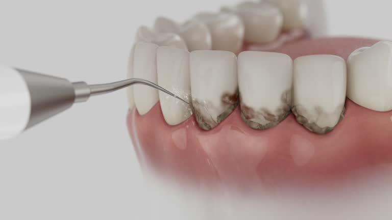 Reliable Dental Implants contractor in Mount Hermon, VA by Smile Center Dentistry
